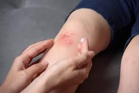 Best Ointment Manufacturer in India