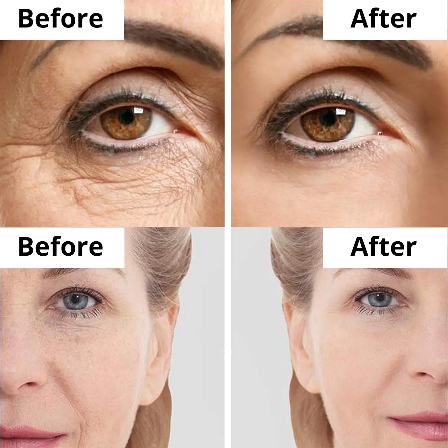 Top 10 Argireline Creams in India